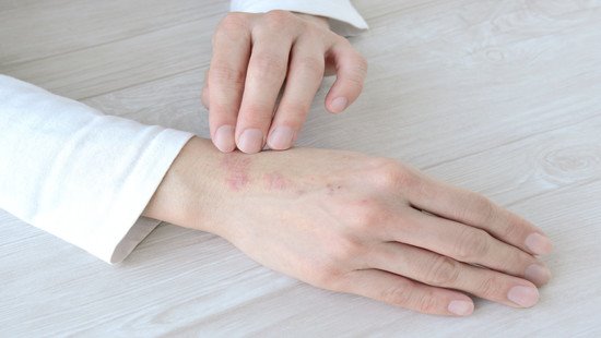 治らない手首痛と長年の首こり